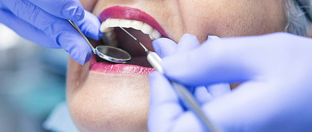 Professional Emergency Dental Service in AL